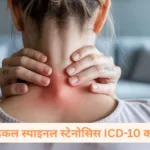 सर्वाइकल स्पाइनल स्टेनोसिस ICD-10