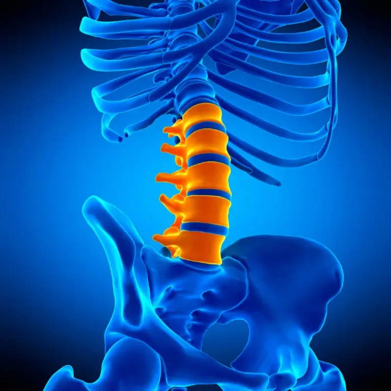 LOWER BACK PAIN