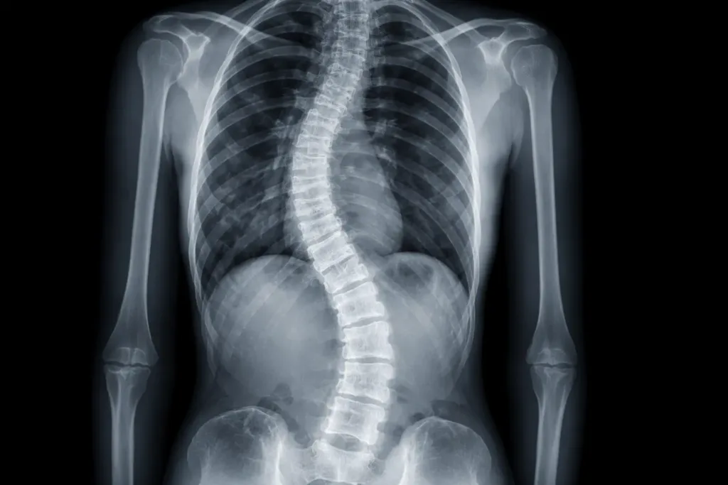 low back pain x-ray